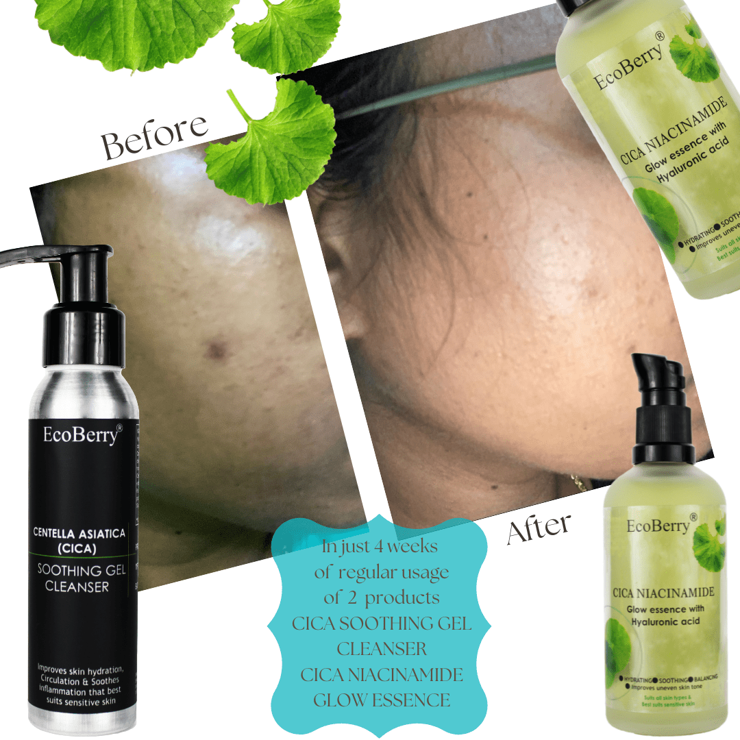 Centella Asiatica (CICA) Niacinamide Glow Essence With Hyaluronic Acid - EcoBerry
