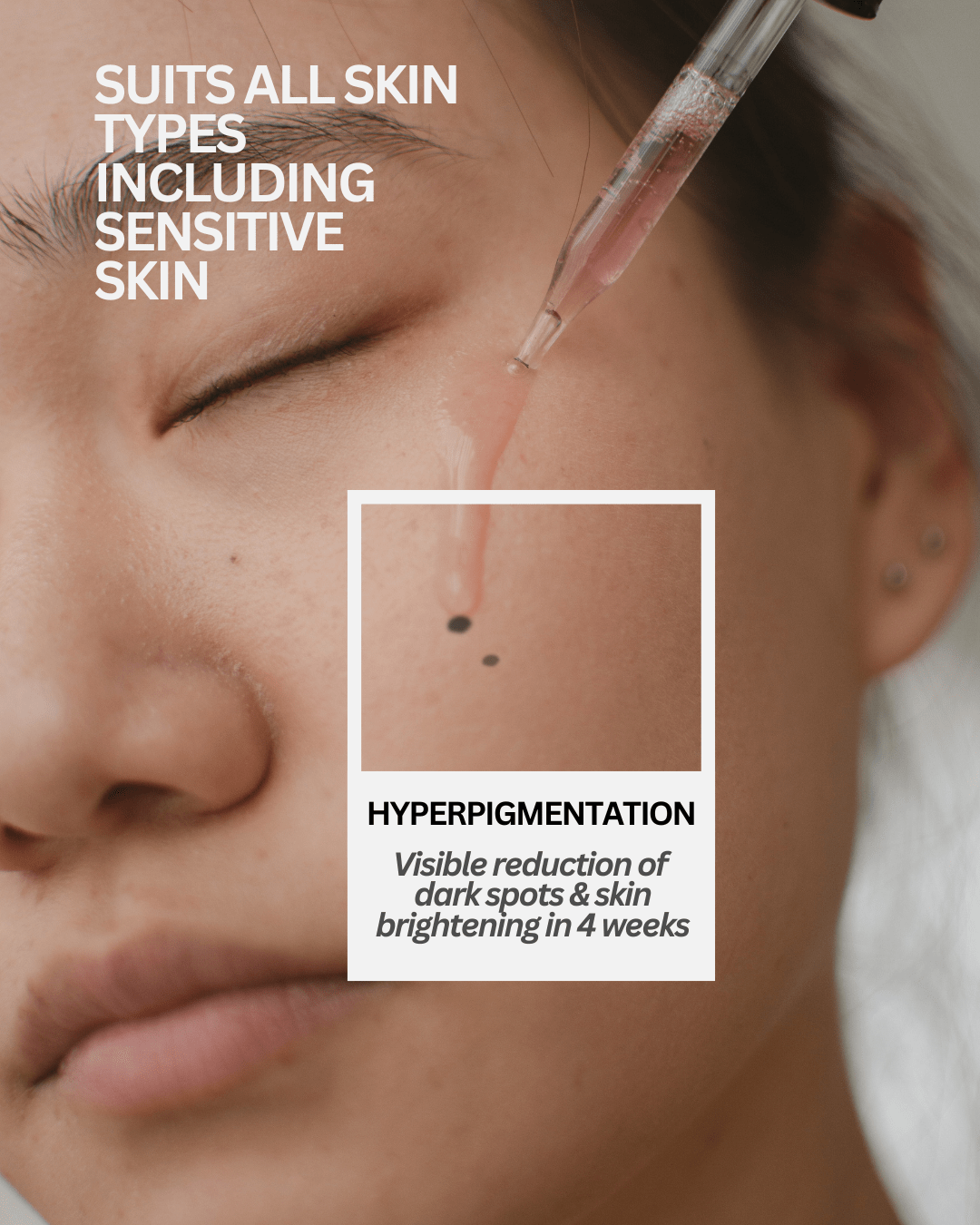 Milk Glow Brightening Serum With Black Rice Extract, Alpha Arbutin, Niacinamide & Hyaluronic Acid - EcoBerry